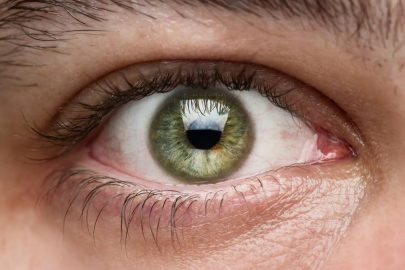 ¿Los ojos claros son más sensibles?